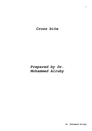 1
Dr. Mohammed Alruby
Cross bite
Prepared by Dr.
Mohammed Alruby
 