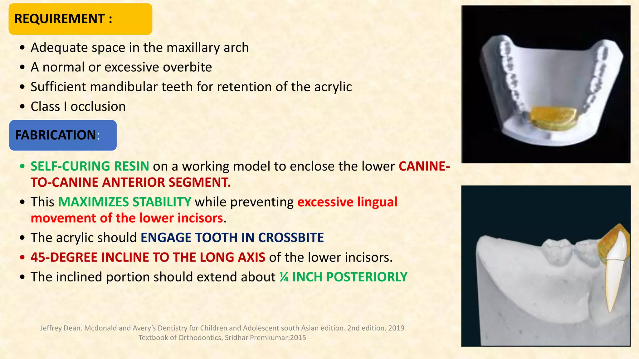 Teeth Incliners crossbite.pptx