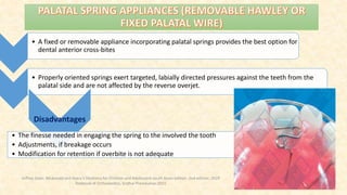 • A fixed or removable appliance incorporating palatal springs provides the best option for
dental anterior cross-bites
• Properly oriented springs exert targeted, labially directed pressures against the teeth from the
palatal side and are not affected by the reverse overjet.
Disadvantages
• The finesse needed in engaging the spring to the involved the tooth
• Adjustments, if breakage occurs
• Modification for retention if overbite is not adequate
Jeffrey Dean. Mcdonald and Avery’s Dentistry for Children and Adolescent south Asian edition. 2nd edition. 2019
Textbook of Orthodontics, Sridhar Premkumar:2015
 