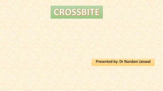 Presented by: Dr Nandani Jaiswal
 