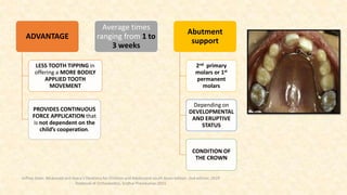 ADVANTAGE
LESS TOOTH TIPPING in
offering a MORE BODILY
APPLIED TOOTH
MOVEMENT
PROVIDES CONTINUOUS
FORCE APPLICATION that
is not dependent on the
child’s cooperation.
Average times
ranging from 1 to
3 weeks
Abutment
support
2nd primary
molars or 1st
permanent
molars
Depending on
DEVELOPMENTAL
AND ERUPTIVE
STATUS
CONDITION OF
THE CROWN
Jeffrey Dean. Mcdonald and Avery’s Dentistry for Children and Adolescent south Asian edition. 2nd edition. 2019
Textbook of Orthodontics, Sridhar Premkumar:2015
 
