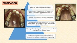 Bands are fitted to selected abutments
The anchor wire is approximate the palatal arch
about 5 mm lingual to the anterior teeth in
crossbite.
provides accurate space for active component.
Passively, the helical loop extends from the anchor
wire to rest on the cutoff incisal table, with the free
end at the labial surface.
The original positioning of the palatal anchor wire about
5 mm behind the crossbite teeth.
Careful soldering of the spring to the palatal wire
completes the appliance in preparation for polishing.
FABRICATION
 