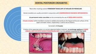 Most often involving isolated PERMANENT MAXILLARY 1ST MOLARS OR PREMOLARS
Dental crossbites are usually corrected in conjunction with COMPREHENSIVE EDGEWISE ORTHODONTICS.
1st permanent molar cross-bites can be corrected by the use of CROSS-ARCH ELASTICS
A hook or button (either bonded to enamel or welded onto bands) on the lingual and buccal surfaces of the
upper and lower molars, respectively, is used to secure elastics.
Corrected in 4–8 weeks
If either of the opposing molars is in correct alignment before treatment, an anchorage appliance (LOWER
LINGUAL ARCH OR UPPER NANCE/TRANSPALATAL BAR) may help prevent movement of that tooth
DENTAL POSTERIOR CROSSBITES
 