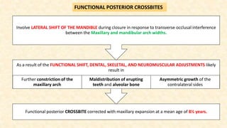 Functional posterior CROSSBITE corrected with maxillary expansion at a mean age of 8½ years.
As a result of the FUNCTIONAL SHIFT, DENTAL, SKELETAL, AND NEUROMUSCULAR ADJUSTMENTS likely
result in
Further constriction of the
maxillary arch
Maldistribution of erupting
teeth and alveolar bone
Asymmetric growth of the
contralateral sides
Involve LATERAL SHIFT OF THE MANDIBLE during closure in response to transverse occlusal interference
between the Maxillary and mandibular arch widths.
FUNCTIONAL POSTERIOR CROSSBITES
 