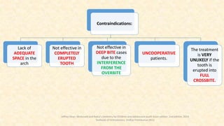 Contraindications:
Lack of
ADEQUATE
SPACE in the
arch
Not effective in
COMPLETELY
ERUPTED
TOOTH
Not effective in
DEEP BITE cases
due to the
INTERFERENCE
FROM THE
OVERBITE
UNCOOPERATIVE
patients.
The treatment
is VERY
UNLIKELY if the
tooth is
erupted into
FULL
CROSSBITE.
Jeffrey Dean. Mcdonald and Avery’s Dentistry for Children and Adolescent south Asian edition. 2nd edition. 2019
Textbook of Orthodontics, Sridhar Premkumar:2015
 