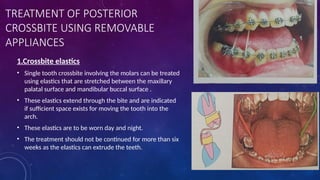 crossbite orthodontics final yearl bds.pptx