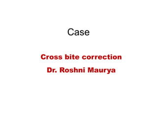 Case
Cross bite correction
Dr. Roshni Maurya
 