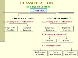 CLASSIFICATION
                            [I] Based on Location
                                  Cross bite

          ANTERIOR CROSS BITE                            POSTERIOR CROSS BITE
a. According to no. of teeth involved            a. According to no. of teeth involved


  Single tooth         Segmental                    Single tooth           Segmental
   Cross bite          Cross bite                    Cross bite            Cross bite

                                                 b. According to side involved


                                                     Unilateral            Bilateral

                                                 c. According to extent


                                        Single posture        Buccal            Lingual
                                          Cross bite       Non-occlusion      Non-occlusion
 