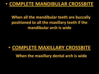 • COMPLETE MANDIBULAR CROSSBITE
When all the mandibular teeth are buccally
positioned to all the maxillary teeth if the
mandibular arch is wide

• COMPLETE MAXILLARY CROSSBITE
When the maxillary dental arch is wide

 