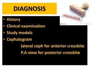 DIAGNOSIS
•
•
•
•

History
Clinical examination
Study models
Cephalogram
lateral ceph for anterior crossbite
P.A view for posterior crossbite

 