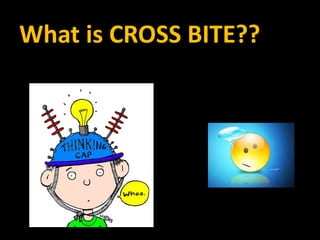 What is CROSS BITE??

 