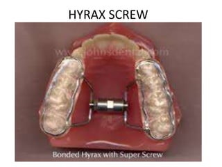 HYRAX SCREW

 