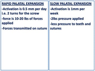 RAPID PALATAL EXPANSION
-Activation is 0.5 mm per day
i.e. 2 turns for the screw
-force is 10-20 lbs of forces
applied
-Forces transmitted on suture

SLOW PALATAL EXPANSION
-Activation is 1mm per
week
-2lbs pressure applied
-less pressure to teeth and
sutures

 