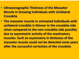 • Ultrasonographic Thickness of the Masseter
Muscle in Growing Individuals with Unilateral
Crossbite
• The masseter muscle in untreated individuals with
unilateral crossbite is thinner in the crossbite side
when compared to the non-crossbite side possibly
due to asymmetric activity of the masticatory
muscles. Such an asymmetry in thickness of the
masseter muscle could not be detected some years
after the successful correction of the crossbite.

 