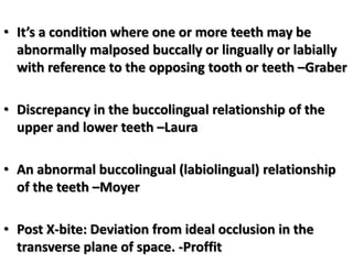 • It’s a condition where one or more teeth may be
abnormally malposed buccally or lingually or labially
with reference to the opposing tooth or teeth –Graber
• Discrepancy in the buccolingual relationship of the
upper and lower teeth –Laura
• An abnormal buccolingual (labiolingual) relationship
of the teeth –Moyer
• Post X-bite: Deviation from ideal occlusion in the
transverse plane of space. -Proffit

 