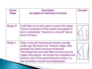 Tanner
Stage
Description
(as applies to transsexual woman)
Example
Stage IV It will take one to two years to reach this stage.
There is projection of the areola and papilla to
form a secondary "mound on a mound" above
level of breast.
Stage V Only a very few transsexual women (usually
under age 20) reach this "mature" stage, after
perhaps two years hormone treatment.
The breast has now fully filled out and only the
nipple still projects, the areola has recessed and
become part of the general breast contour i.e.
the secondary mound has disappeared.
 