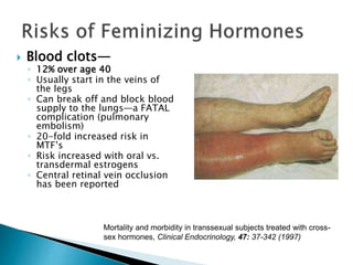  Blood clots—
◦ 12% over age 40
◦ Usually start in the veins of
the legs
◦ Can break off and block blood
supply to the lungs—a FATAL
complication (pulmonary
embolism)
◦ 20-fold increased risk in
MTF’s
◦ Risk increased with oral vs.
transdermal estrogens
◦ Central retinal vein occlusion
has been reported
Mortality and morbidity in transsexual subjects treated with cross-
sex hormones, Clinical Endocrinology, 47: 37-342 (1997)
 