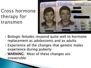  Biologic females respond quite well to hormone
replacement as adolescents and as adults
 Experience all the changes that genetic males
experience during puberty
 WARNING: Most of these changes are
irreversible
 