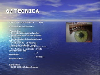 6/ TECNICA Duración del procedimiento:  1 Hora Secuencia del Tratamiento : - Paquimetría - Desepitelización corneal partial - Administración tópica de gotas de fotoactivador - Comprobación de la saturación del fotoactivador - Irradiación UV – 30 minutos  - Durante la irradiación ,seguir administrando el fotoactivador cada 5 mn - Tras finalizar la irradiación , lavado abundante con BSS , LC terapéutica , Tto local+ general de PRK Revisiones :  D1,D4-5,D8,D15,1mes,3 meses 