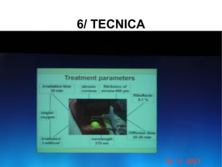 6/ TECNICA 