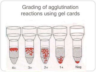 Grading of agglutination
reactions using gel cards
 
