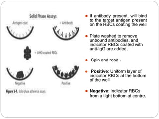 ⚫ If antibody present, will bind
to the target antigen present
on the RBCs coating the well
⚫ Plate washed to remove
unbound antibodies, and
indicator RBCs coated with
anti-IgG are added,
⚫ Spin and read:-
⚫ Positive: Uniform layer of
indicator RBCs at the bottom
of the well
⚫ Negative: Indicator RBCs
from a tight bottom at centre.
 