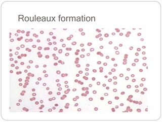 Rouleaux formation
 
