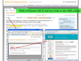 Web of Science (SCI) full text link to the KJR article
 