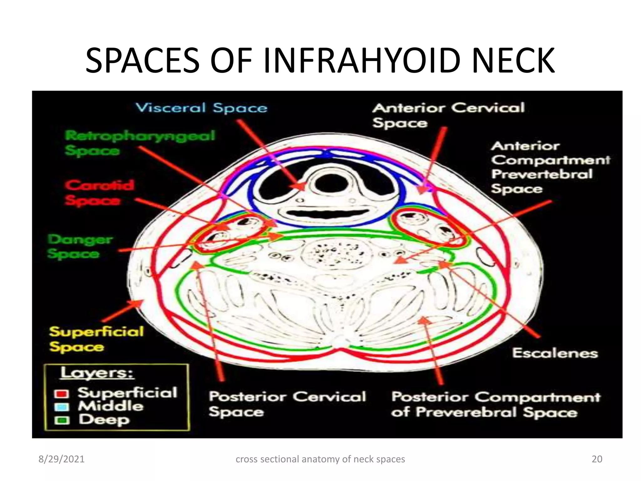 SPACES OF INFRAHYOID NECK
cross sectional anatomy of neck spaces 20
8/29/2021
 