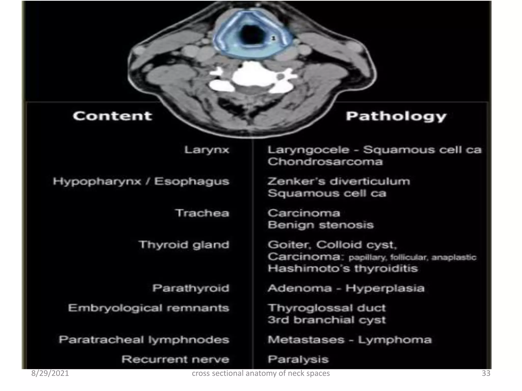 cross sectional anatomy of neck spaces 33
8/29/2021
 