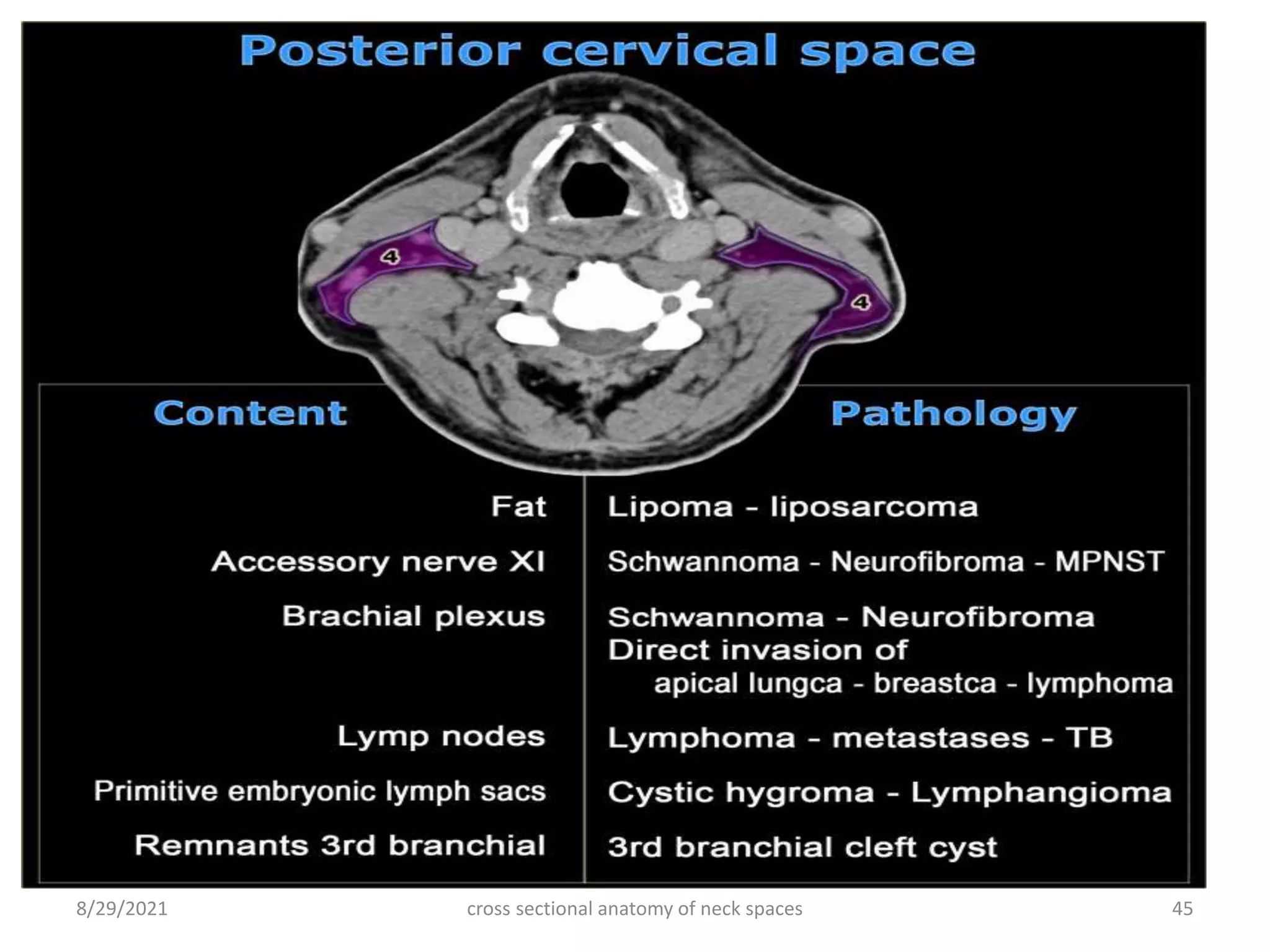 cross sectional anatomy of neck spaces 45
8/29/2021
 