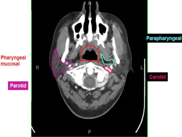 Neck Ct Scan Anatomy Radiology Ct Scan Machine