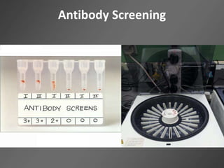 Antibody Screening
 