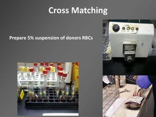Cross Matching
Prepare 5% suspension of donors RBCs
 