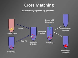 Cross Matching
Patient serum
2 drops
Incubation
37oC, 1 hr
Donor RBC
1 drop, 5%
3 washes
Centrifuge
2 drops AHG
Mix properly
No agglutination =
compatible
Detects clinically significant (IgG) antibody
Agglutination =
incompatible
 