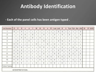 Antibody Identification
- Each of the panel cells has been antigen typed .
 