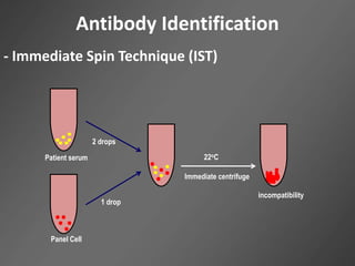 Antibody Identification
- Immediate Spin Technique (IST)
Patient serum
2 drops
Panel Cell
1 drop
Immediate centrifuge
incompatibility
22oC
 