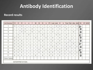 Antibody Identification
2+
0
0
2+
0
0
2+
0
0
2+
0
Record results
 