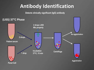 Antibody Identification
Incubation
37oC, 15 min
Centrifuge
2 drops LISS
Mix properly
Agglutination
No agglutination
Detects clinically significant (IgG) antibody
(LISS) 37°C Phase
Patient serum
2 drops
Panel Cell
1 drop
 