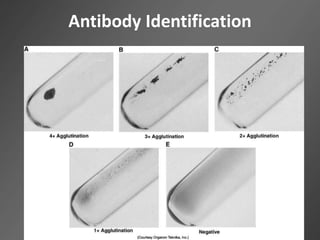 Antibody Identification
 