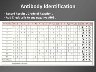 Antibody Identification
2+
0
0
2+
0
0
2+
0
0
2+
0
0
0
0
0
0
0
0
0
0
0
0
0
0
0
0
0
0
0
0
0
0
0
0 0 0
- Record Results , Grade of Reaction .
- Add Check cells to any negative AHG .
 