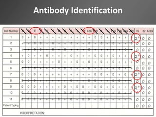 Antibody Identification
 