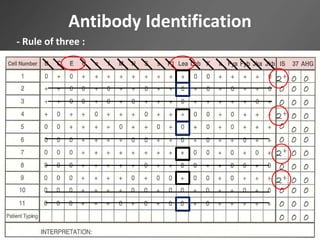 Antibody Identification
- Rule of three :
 