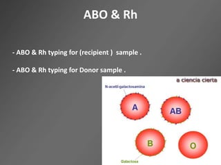 ABO & Rh
- ABO & Rh typing for (recipient ) sample .
- ABO & Rh typing for Donor sample .
 