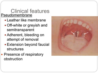 Croup syndrome( diptheria,acute epiglottitis,aryngotracheobronchitis ...