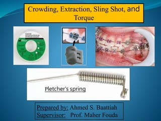 Crowding, Extraction, Sling Shot, and
Torque
Pletcher's spring
Prepared by: Ahmed S. Baattiah
Supervisor: Prof. Maher Fouda
 