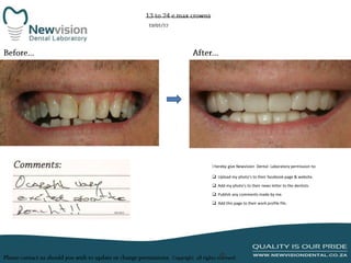 I hereby give Newvision Dental Laboratory permission to:
 Upload my photo’s to their facebook page & website.
 Add my photo’s to their news letter to the dentists.
 Publish any comments made by me.
 Add this page to their work profile file.

 