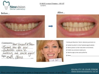 I hereby give Newvision Dental Laboratory permission to:
 Upload my photo’s to their facebook page & website.
 Add my photo’s to their news letter to the dentists.
 Publish any comments made by me.
 Add this page to their work profile file.

 Notes:______________________________________________

 