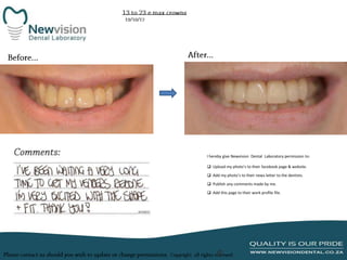 I hereby give Newvision Dental Laboratory permission to:
 Upload my photo’s to their facebook page & website.
 Add my photo’s to their news letter to the dentists.
 Publish any comments made by me.
 Add this page to their work profile file.

 