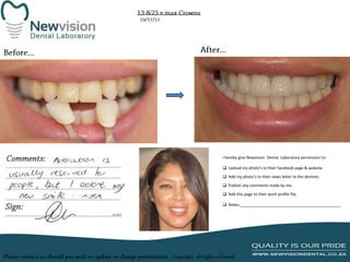 I hereby give Newvision Dental Laboratory permission to:
 Upload my photo’s to their facebook page & website.
 Add my photo’s to their news letter to the dentists.
 Publish any comments made by me.
 Add this page to their work profile file.
 Notes:______________________________________________

 